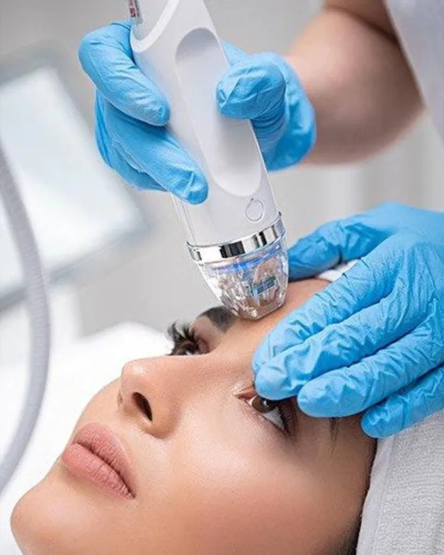 Microneedling