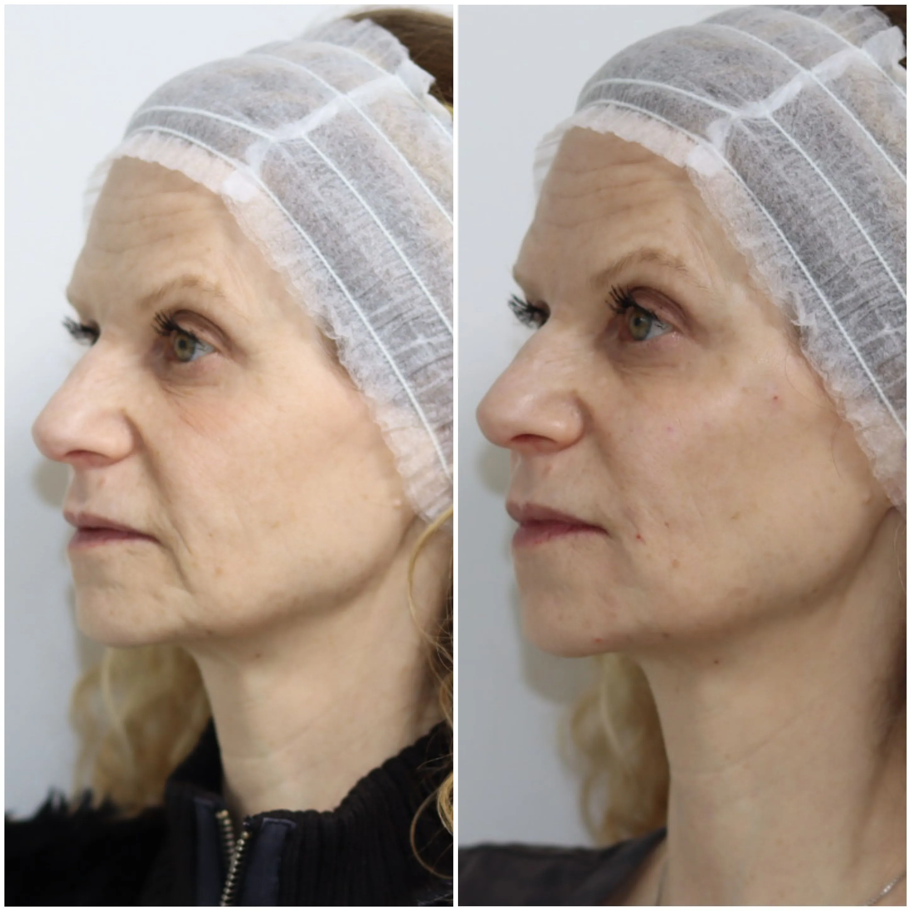 Client transformation 1