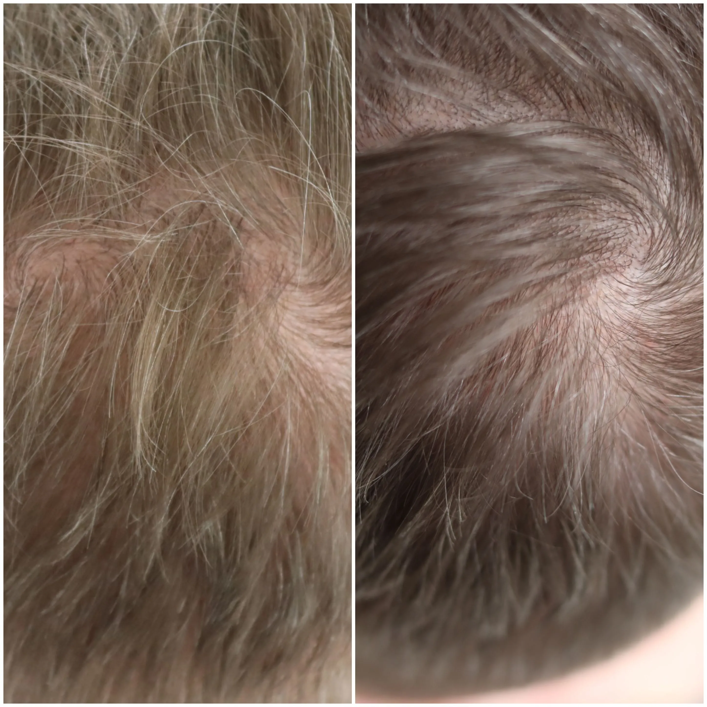 Client transformation 2