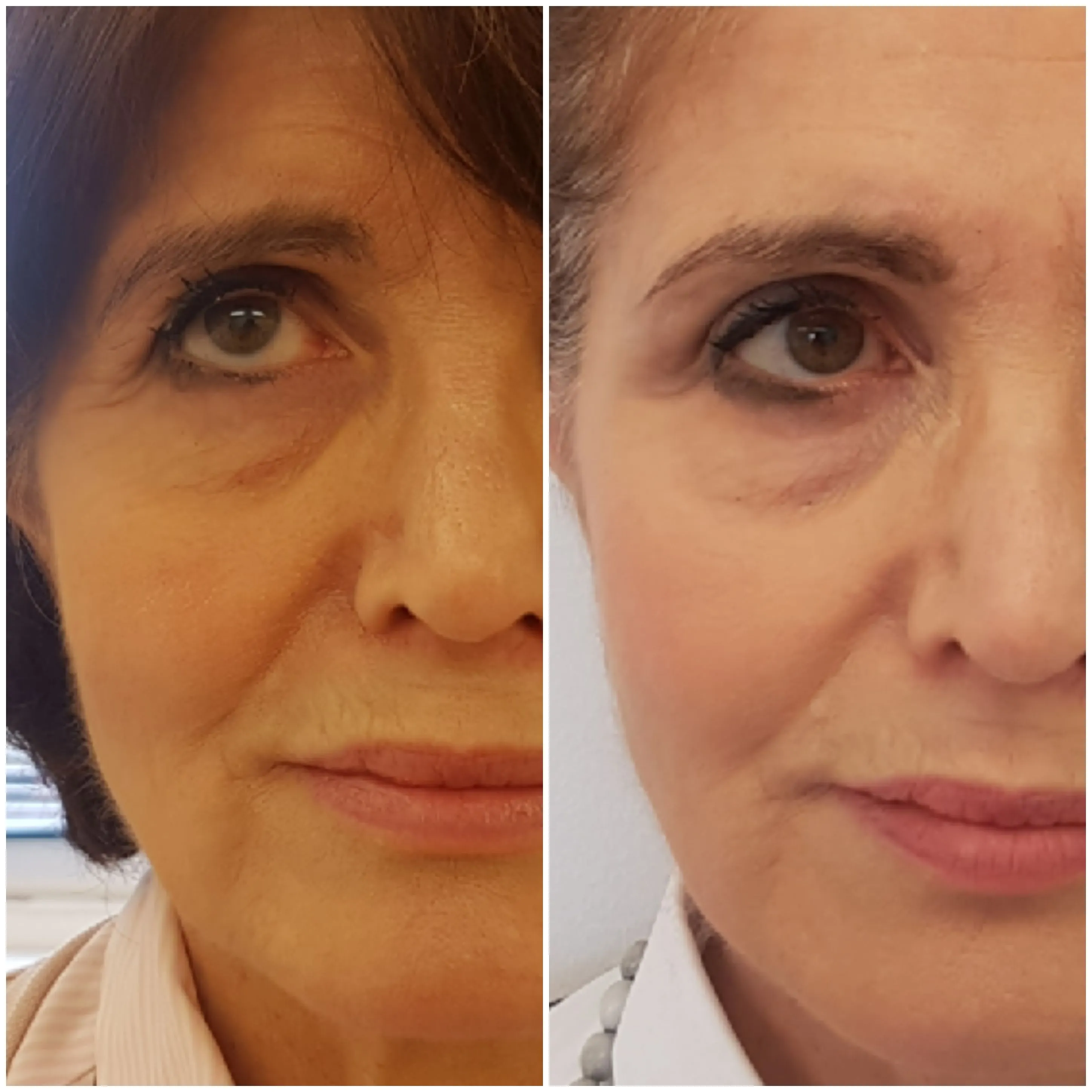 Client transformation 3