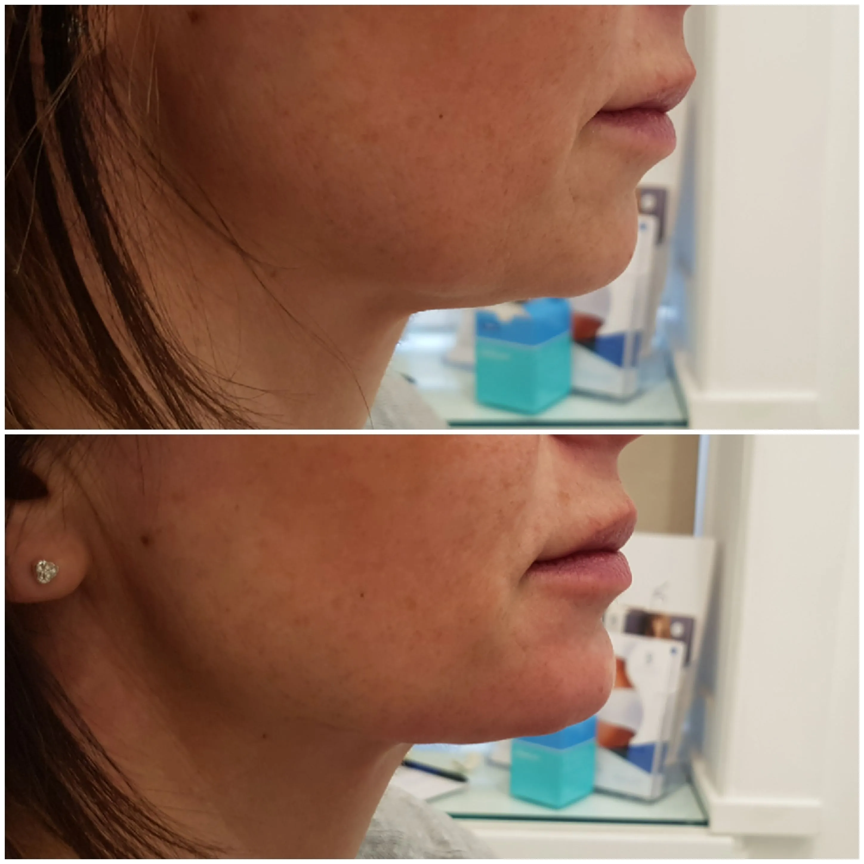 Client transformation 4