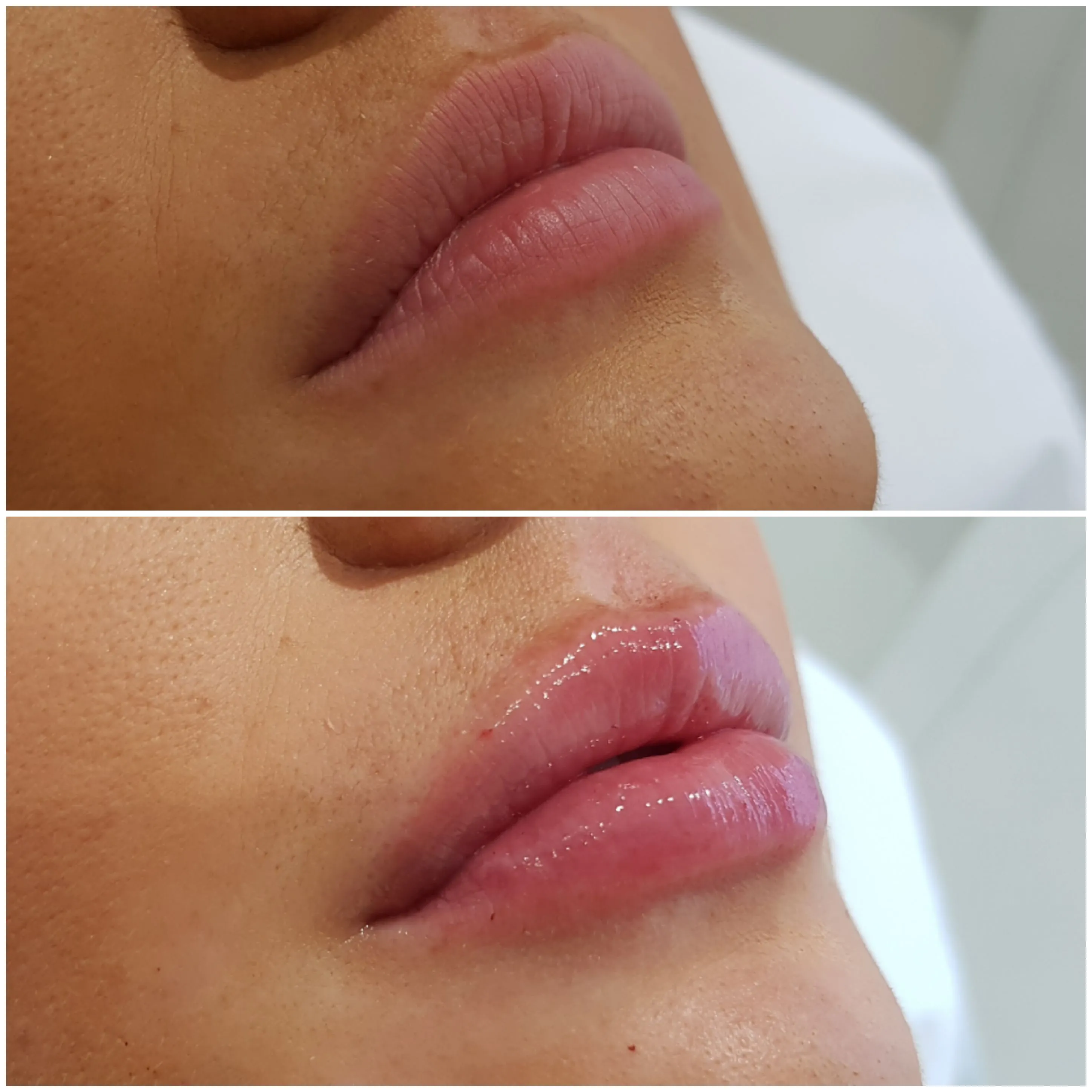 Client transformation 5